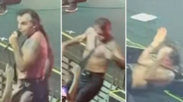 Piero Pelù cade durante il concerto, poi posta le lastre sui social Piero Pelù cade durante il concerto, poi posta le lastre sui social