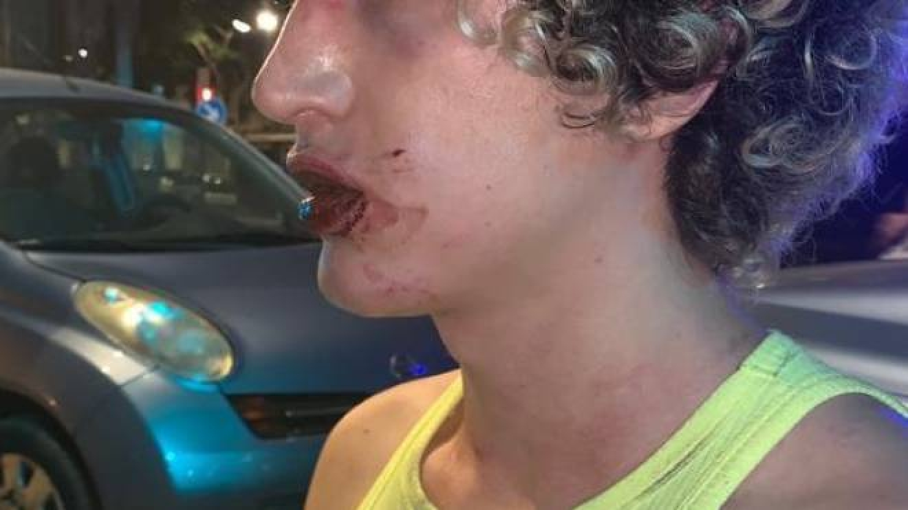 Ragazzi Aggrediti In Spagna La Denuncia Picchiati E Offesi Perche Gay Video Cronaca