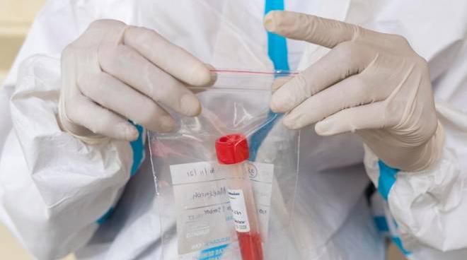 variante omicron cos e sintomi trasmissibilita vaccini iss domande e risposte cronaca